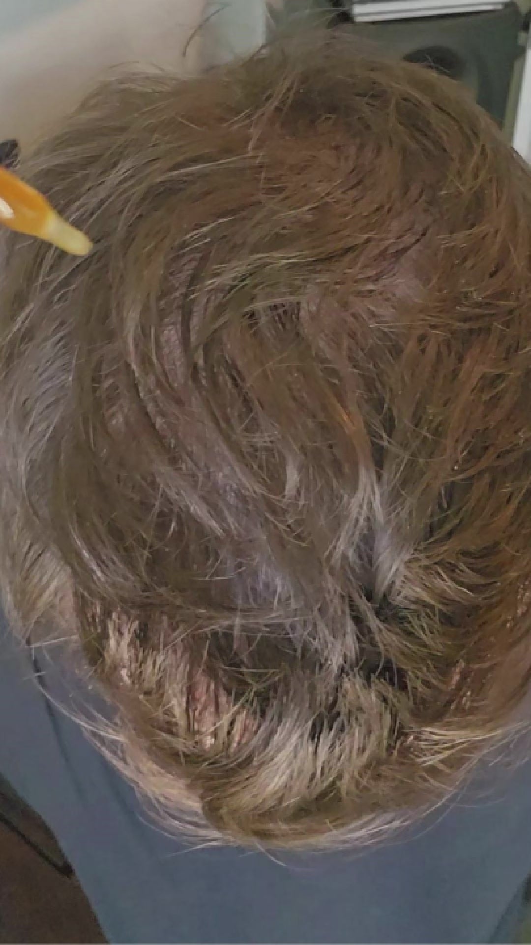 Load video: peptide hair amplifier applied to the scalp